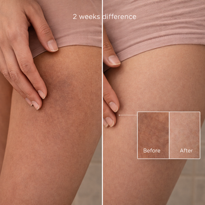 Fade Dark Spots & Smooth Uneven Skin — Without Harsh Scrubs