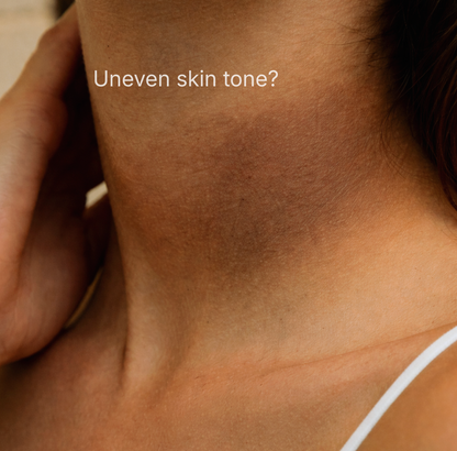 Fade Dark Spots & Smooth Uneven Skin — Without Harsh Scrubs